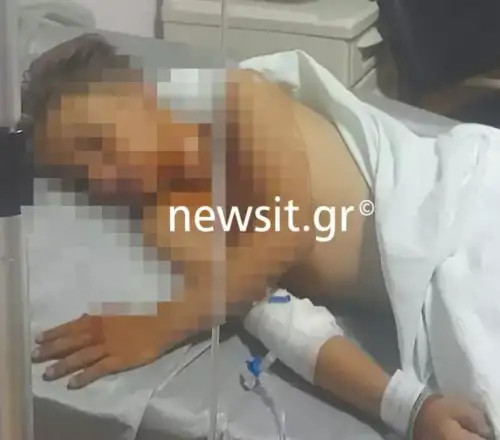 Πάτρα: «Ζήσαμε εμπόλεμες συνθήκες, ο γιος μου με ρώτησε αν θα πεθάνει», λέει στο newsit.gr ο πατέρας του 9χρονου που τραυματίστηκε από βεγγαλικά